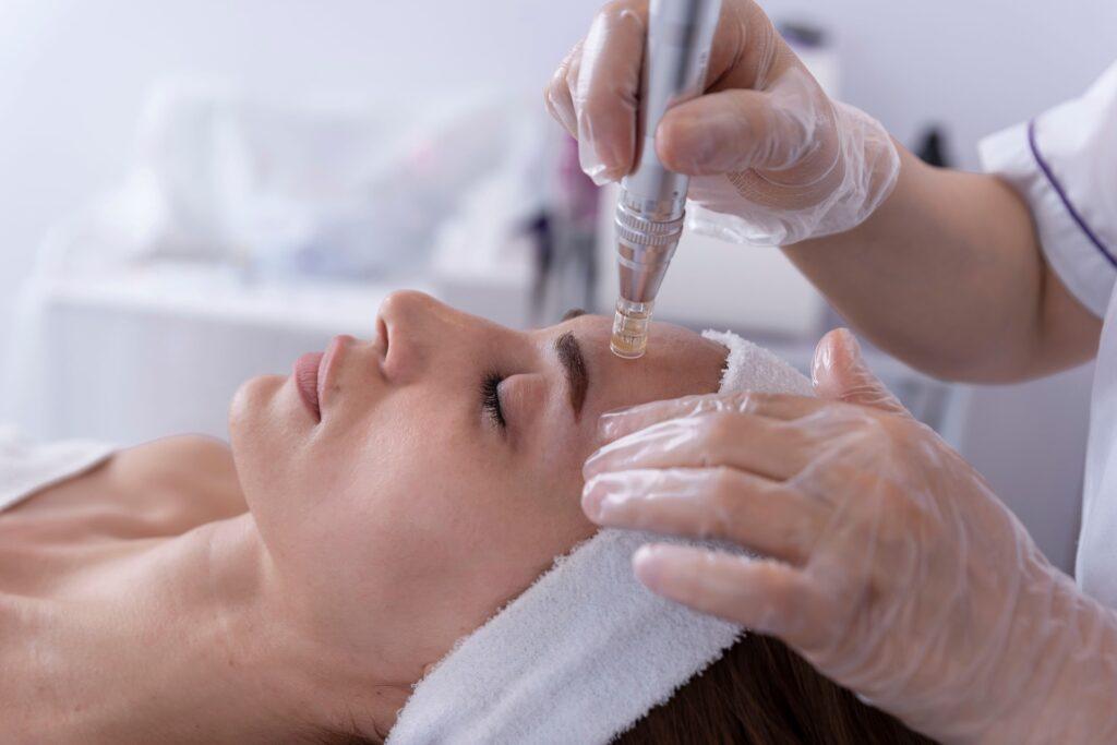 Microneedling-Anwendung im Kosmetikstudio | Cellulite Behandlung Nürnberg